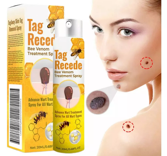 Recede™ Verrugas Fuera, Piel Limpia - [PROMOCIÓN DISPONIBLE SOLO HOY]