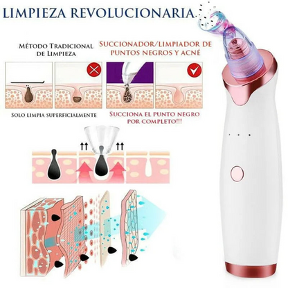 PureSkin™ – Tu Aliado Contra los Puntos Negros y Espinillas - [PROMOCIÓN DISPONIBLE SOLO HOY]