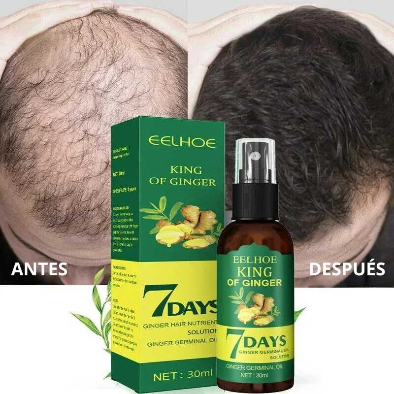 Ginger™ Serum 7 Days: Crecimiento acelerado de 30ml - [PROMOCIÓN DISPONIBLE SOLO HOY]