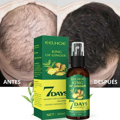 Ginger™ Serum 7 Days: Crecimiento acelerado de 30ml - [PROMOCIÓN DISPONIBLE SOLO HOY]