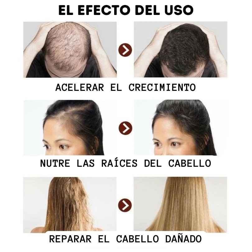 Ginger™ Serum 7 Days: Crecimiento acelerado de 30ml - [PROMOCIÓN DISPONIBLE SOLO HOY]