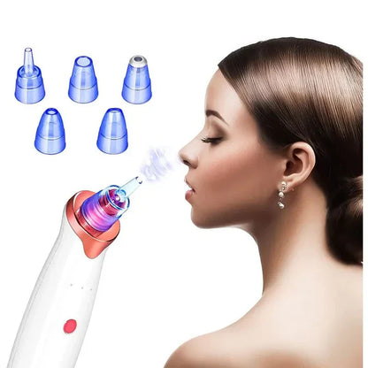 ClearPore™ – Extractor Facial de Puntos Negros y Espinillas